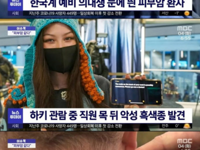 아이스하키 보러 갔다가 피부암 환자 발견한 예비 의대생