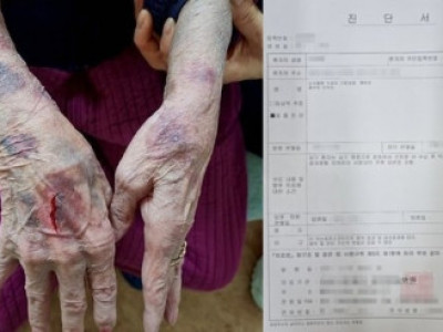 42㎏ 80대 할머니, 갈비뼈 3대 골절…노인센터 잔혹 폭행