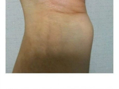 손목브레이커를 본 응급의학과 교수님