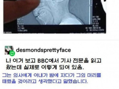 두통때문에 병원에 간 남자