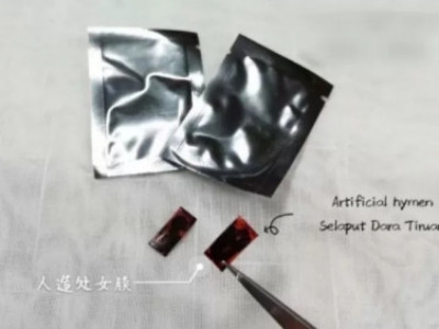 해외)‘혼전 순결’ 지킨 척하려 ‘인공 처녀막’ 구매하는 여성들