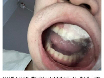 프링글스 뚜껑 입에낀 디씨인