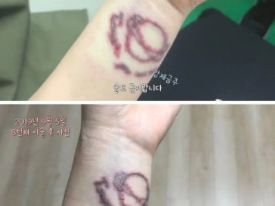 도탁스] 5년동안 손목 타투 지운 후기.jpg