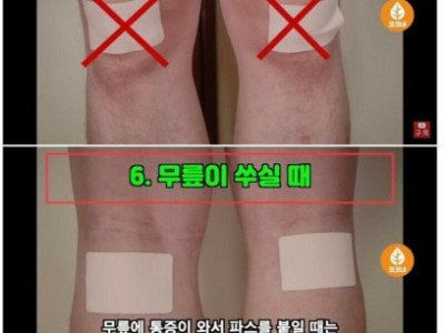 파스 제대로 붙이는 법