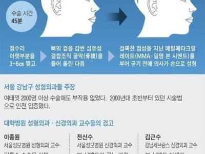 무시무시한 요즘 성형수술.jpg