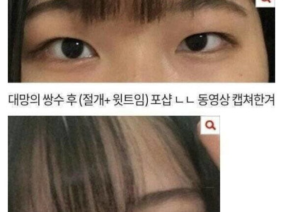 쌍수로 ㄹㅇ 인생역전 했다는 여자.jpg