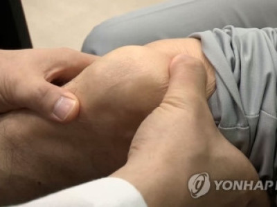 작년 무릎 염증 환자 300만명 넘어…무릎 주변 근력 키워야