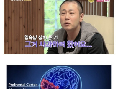 나는 솔로 16기 광수 의료사고를 의심하는 디시인 ㄷ..JPG