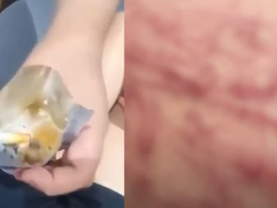 '봉지 소변' 먹이고 온몸에 빨간자국…여중생 셋이 남학생 학대