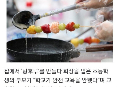 선생님 애가 집에서 화상입었어요!! 책임지세요!!
