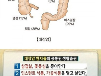 대장암 환자들의 공통된 습관