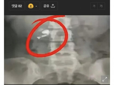 에어팟 끼고 절대 잠들면 안되는 이유 ㄷㄷ.JPG