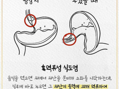 먹고 바로 누우면 안되는 이유.jpg