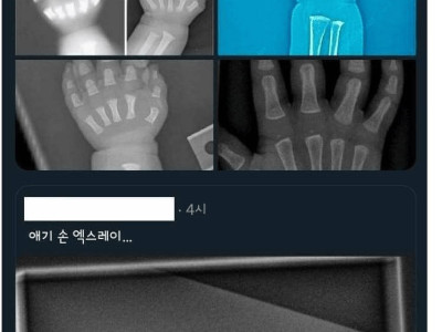 아기들이 통통한 이유.jpg