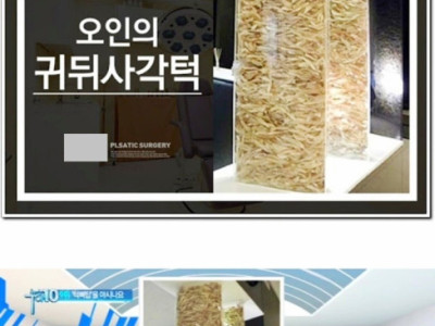 혐주의] 성형외과 국제적 레전드 사건.jpg