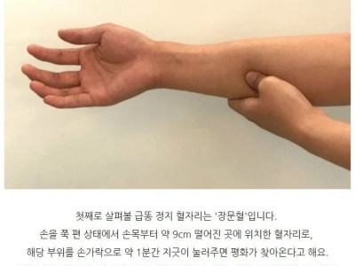 급똥 막아주는 장문혈 후기