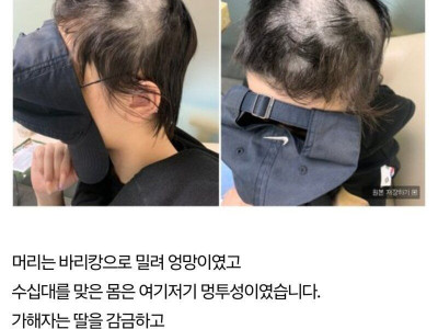 판] 딸이 머리가 바리캉에 밀린 채 구조.jpg