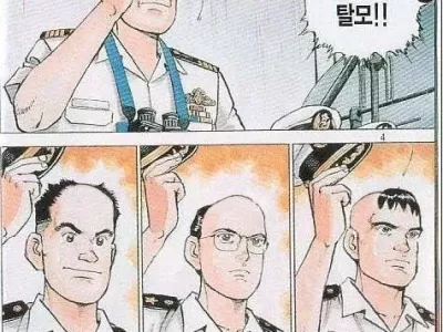 전 대원 탈모