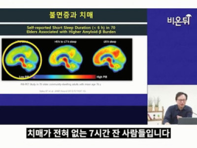 7시간 이상 수면이 필요한 이유 ㄷㄷ