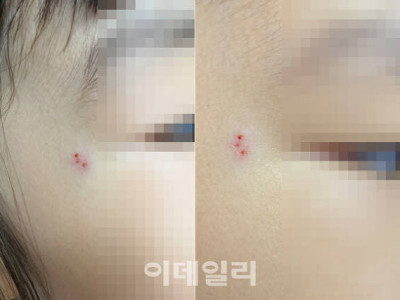 3살 포크로 찌르고 박치기 ‘퍽’...인천 어린이집 학대 의혹