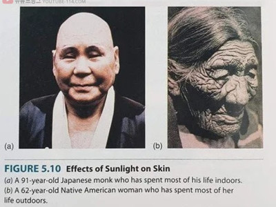 실내 생활한 91살 승려와 62살 미국 원주민의 피부차이.jpg