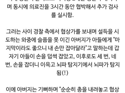 미국이 뇌사판정을 엄격하게 하게된 계기.jpg