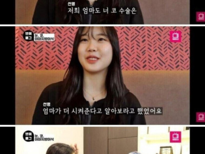 어느 처자의 눈 + 코 성형 후기